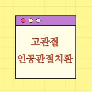 고관절 인공관절치환술 후 궁둥신경 손상에 따른 손해배상 요구