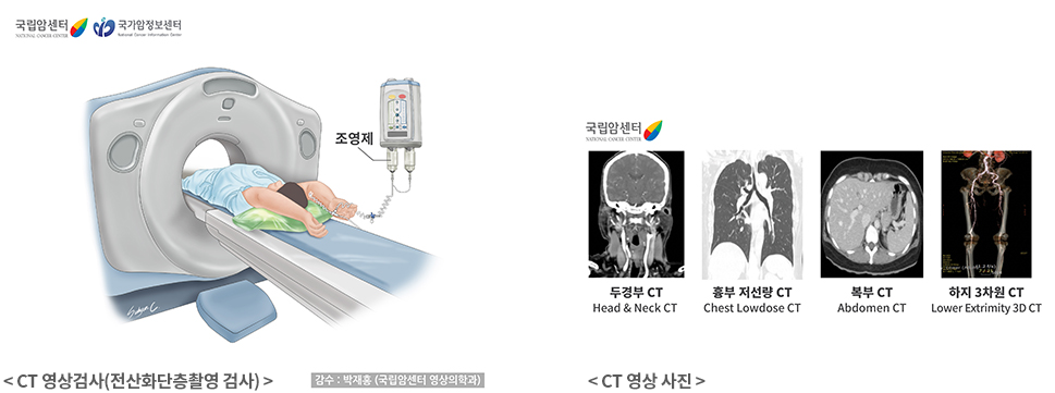 CT검사